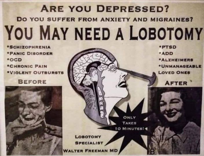 lobotomy